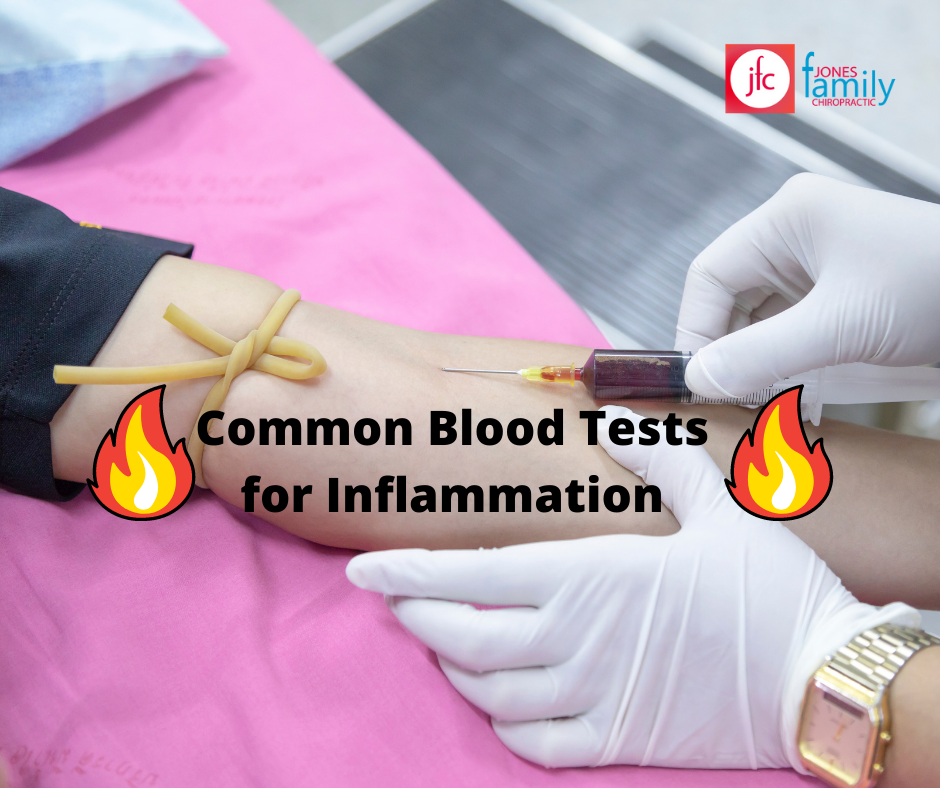 Read more about the article Common blood tests for inflammation – Dr. Jason Jones Elizabeth City, NC, Chiropractor